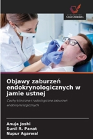 Objawy zaburzen endokrynologicznych w jamie ustnej (Polish Edition) 6209076149 Book Cover