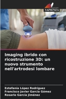 Imaging ibrido con ricostruzione 3D: un nuovo strumento nell'artrodesi lombare (Italian Edition) 6209681778 Book Cover