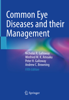 Common Eye Diseases and their Management 3031084497 Book Cover