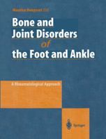 Bone and Joint Disorders of the Foot and Ankle: A Rheumatological Approach 3662061341 Book Cover