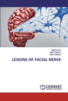 Lesions of Facial Nerve 6202556420 Book Cover