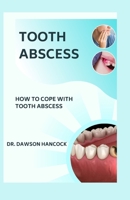 TOOTH ABSCESS: HOW TO COPE WITH TOOTH ABSCESS B0CG8FG46M Book Cover
