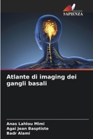Atlante di imaging dei gangli basali (Italian Edition) 6208018129 Book Cover