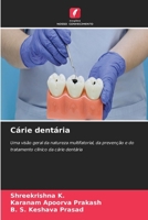 Cárie dentária (Portuguese Edition) 663013141X Book Cover