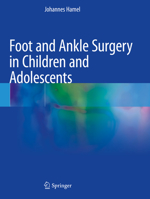 Foot and Ankle Surgery in Children and Adolescents 3030581101 Book Cover