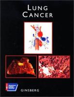Lung Cancer (American Cancer Society Atlas of Clinical Oncology) 1550090992 Book Cover