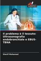 Il problema è il tessuto: Ultrasonografia endobronchiale e EBUS-TBNA 620572572X Book Cover