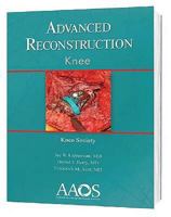 Advanced Reconstruction: Knee 0892034521 Book Cover