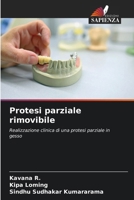 Protesi parziale rimovibile (Italian Edition) 6630043065 Book Cover