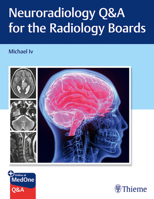 Neuroradiology Q&A for the Radiology Boards 168420559X Book Cover