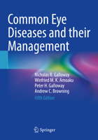 Common Eye Diseases and their Management 3031084527 Book Cover