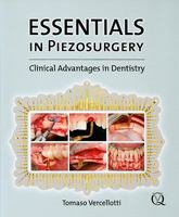 Essentials In Piezosurgery: Clinical Advantages In Dentistry 1850971900 Book Cover