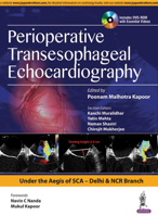 Perioperative Transeasophageal Echocardiography 9386261944 Book Cover