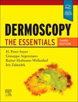 Dermoscopy: The Essentials 0702068829 Book Cover