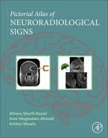 Pictorial Atlas of Neuroradiological Signs 0443235287 Book Cover