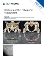 Fractures of the Pelvis and Acetabulum: Principles and Methods of Management 3132006319 Book Cover