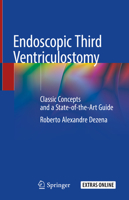 Endoscopic Third Ventriculostomy: Classic Concepts and a State-of-the-Art Guide 3030286568 Book Cover