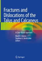 Fractures and Dislocations of the Talus and Calcaneus: A Case-Based Approach 3030373622 Book Cover