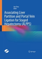 Associating Liver Partition and Portal Vein Ligation for Staged Hepatectomy (ALPPS)/???????????????????(? 7547871445 Book Cover