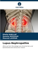 Lupus-Nephropathie 6204100491 Book Cover