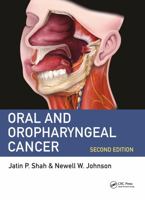 ORAL AND OROPHARYNGEAL CANCER 2ED (PB 2020) 0367438690 Book Cover