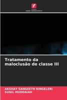 Tratamento da maloclusão de classe III 6630229525 Book Cover