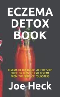 ECZEMA DETOX BOOK: ECZEMA DETOX BOOK: STEP BY STEP GUIDE ON HOW TO END ECZEMA FROM THE BODY OF YOUNSTERS B08NX43V5R Book Cover