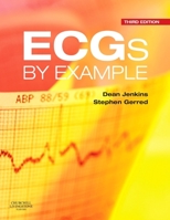 ECGs by Example 0702042285 Book Cover