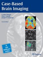 Case-Based Brain Imaging (RadCases) 1604069538 Book Cover