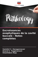 Excroissances exophytiques de la cavité buccale - Notes complètes (French Edition) 6207901320 Book Cover