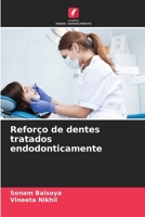 Reforço de dentes tratados endodonticamente 6206727416 Book Cover