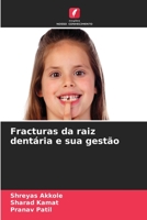 Fracturas da raiz dentária e sua gestão 6205981459 Book Cover