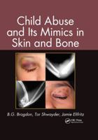 Child Abuse and Its Mimics in Skin and Bone 1439855358 Book Cover