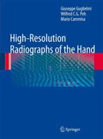 High-Resolution Radiographs of the Hand 364209841X Book Cover