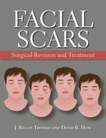 Facial Scars: Surgical Revision and Treatment 160795186X Book Cover