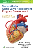 Transcatheter Aortic Valve Replacement Program Development: A Guide for the Heart Team 1975105222 Book Cover