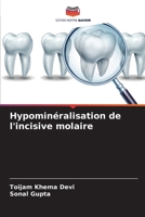 Hypominéralisation de l'incisive molaire 620504806X Book Cover