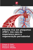 Fibrina rica em plaquetas (PRF): Um raio de esperança para a regeneração periodontal 6207373316 Book Cover
