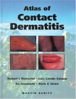 An Atlas of Contact Dermatitis 1853175544 Book Cover