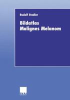 Bildatlas Malignes Melanom 3824421453 Book Cover