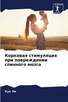 Корковая стимуляция при повреждении спинного мозга 6206137937 Book Cover
