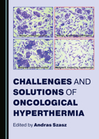 Challenges and Solutions of Oncological Hyperthermia 1527548171 Book Cover