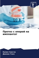 Протез с опорой на имплантат 6205330687 Book Cover