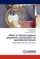 Effect of dental implant abutment connections on periodontal tissues: Dental implant abutment connections 3846592951 Book Cover