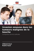 Invasion osseuse dans les tumeurs malignes de la bouche (French Edition) 6207689224 Book Cover