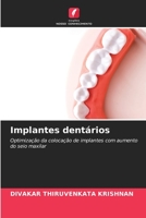 Implantes dentários: Optimização da colocação de implantes com aumento do seio maxilar 6206001555 Book Cover