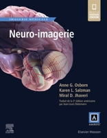 Neuro-imagerie (French Edition) 2294761359 Book Cover