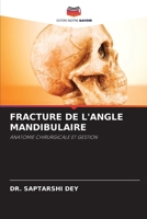 FRACTURE DE L'ANGLE MANDIBULAIRE: ANATOMIE CHIRURGICALE ET GESTION (French Edition) B0CJBNRGFS Book Cover