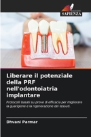 Liberare il potenziale della PRF nell'odontoiatria implantare: Protocolli basati su prove di efficacia per migliorare la guarigione e la rigenerazione dei tessuti. (Italian Edition) 6208817188 Book Cover