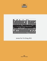 A rare endemic fungal disease the Coccidioidomycosis 1733625135 Book Cover